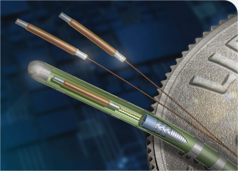 diagram of electromagnetic sensor wire inside of the sensor